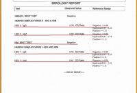 Incident Report Book Template New Sample Of Investigation Report In the Workplace Glendale Community